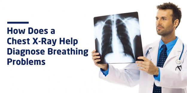 How Does a Chest X-Ray Help Diagnose Breathing Problems? - Blog ...